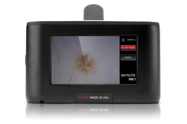Dermlite Cam Fotocamera digitale  dermatoscopia