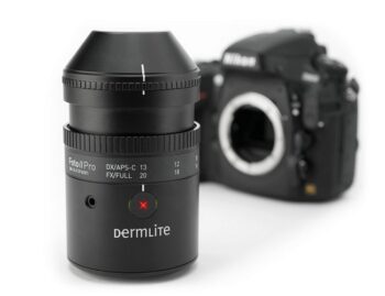 Dermlite Foto II Pro, obiettivo per dermoscopia con reflex digitali