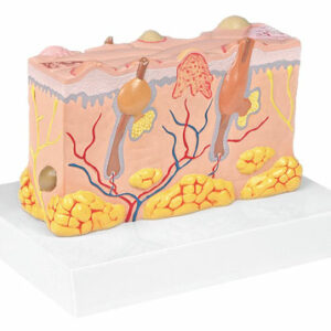 Modello patologie della pelle lato  I