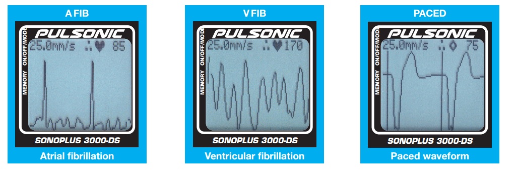 Sonoplus immagini schermo