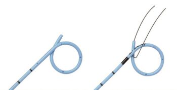 Stent uretrale