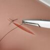 Esempio di utilizzo trainer per sutura