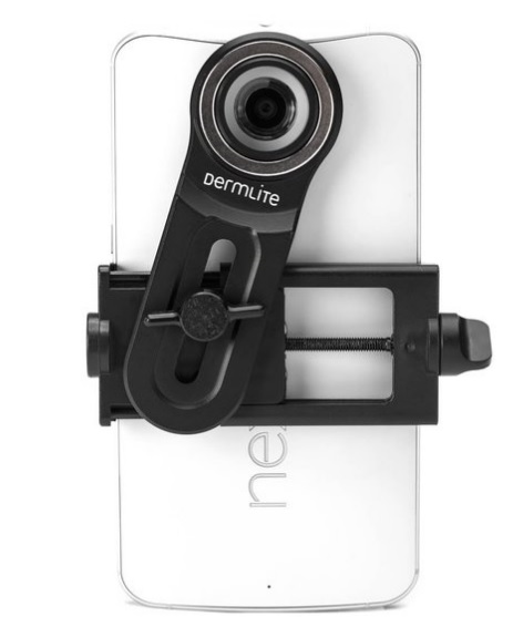 Adattatore universale Dermlite-Smartphone