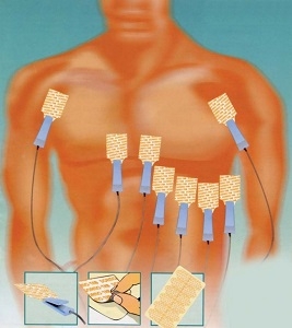 Elettrodi (monitoraggio)